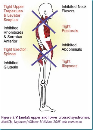 crossedsyndrome